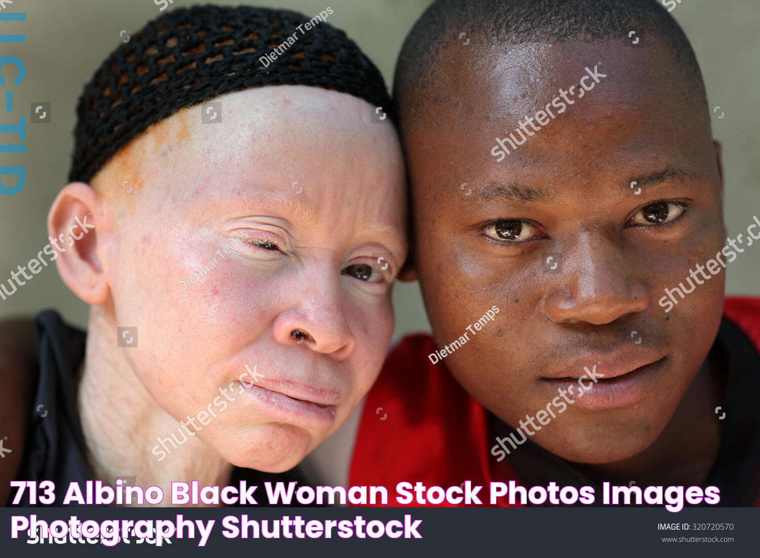 713 Albino black woman Stock Photos, Images & Photography Shutterstock