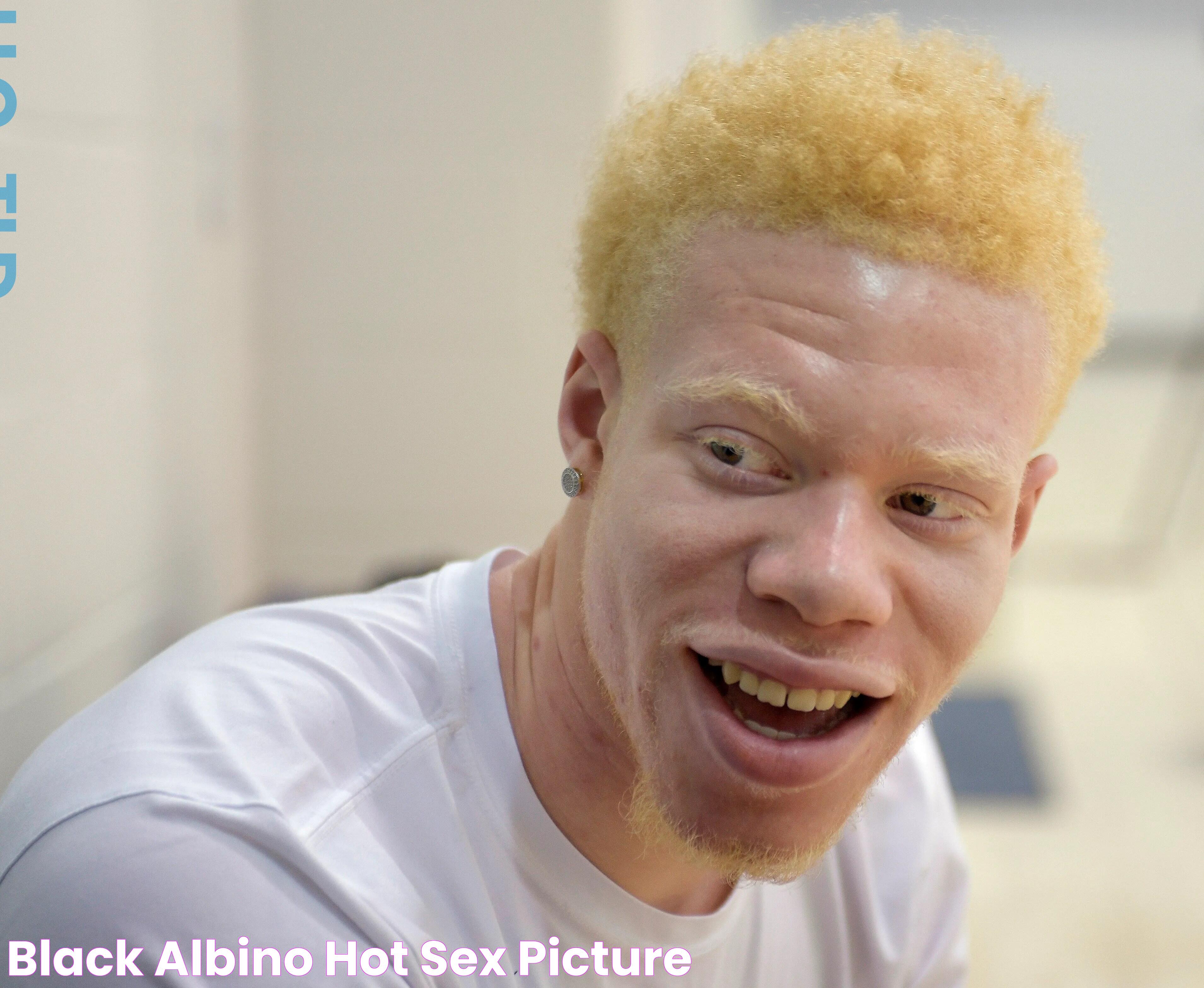 Black Albino Hot Sex Picture