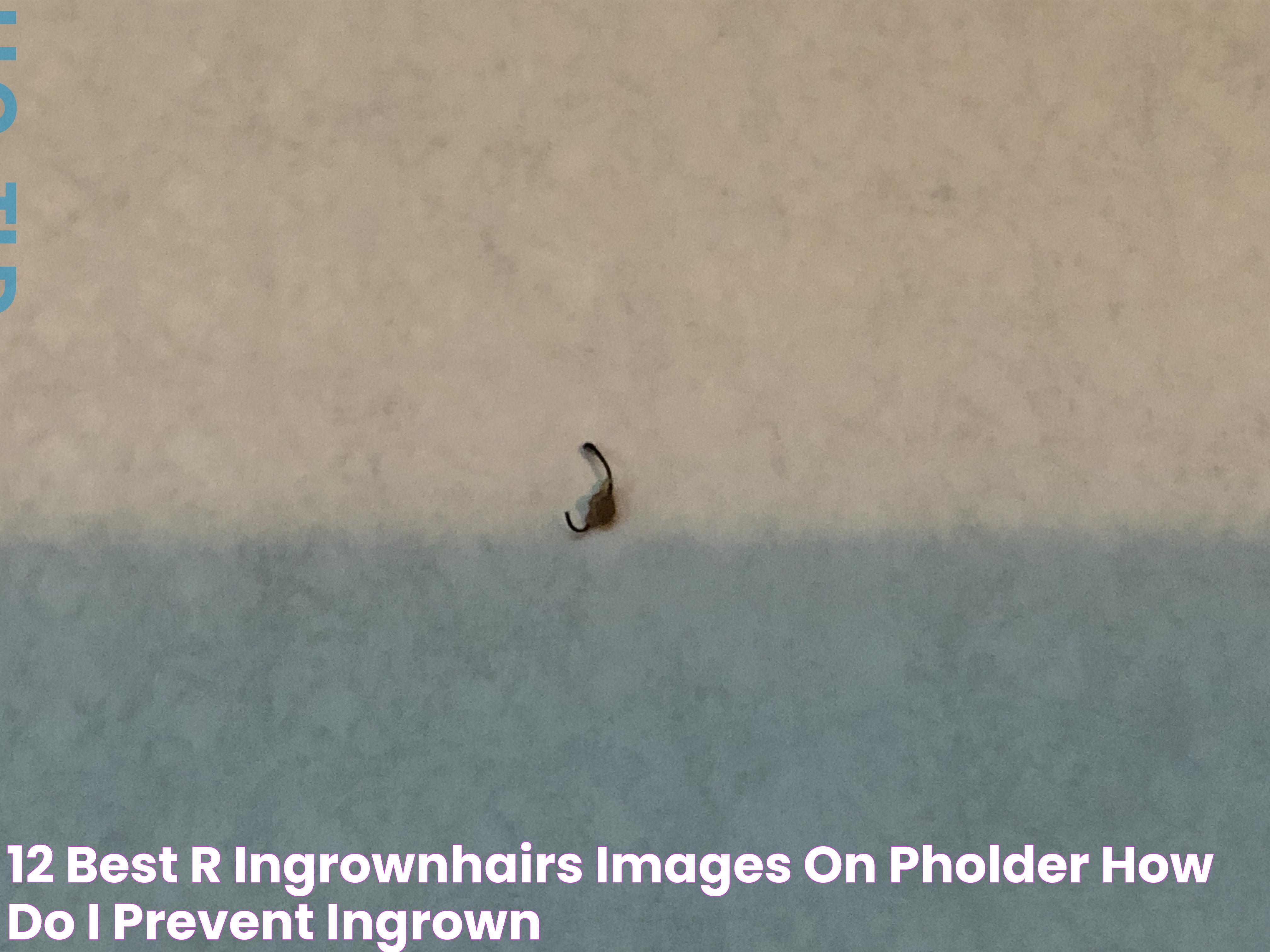 12 best r/ingrownhairs images on Pholder How do I prevent ingrown