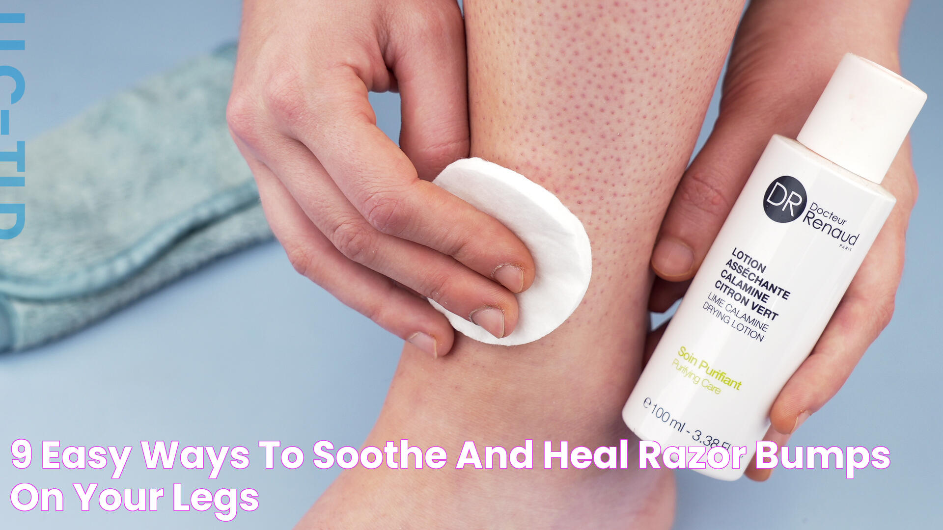 9 Easy Ways to Soothe and Heal Razor Bumps on Your Legs