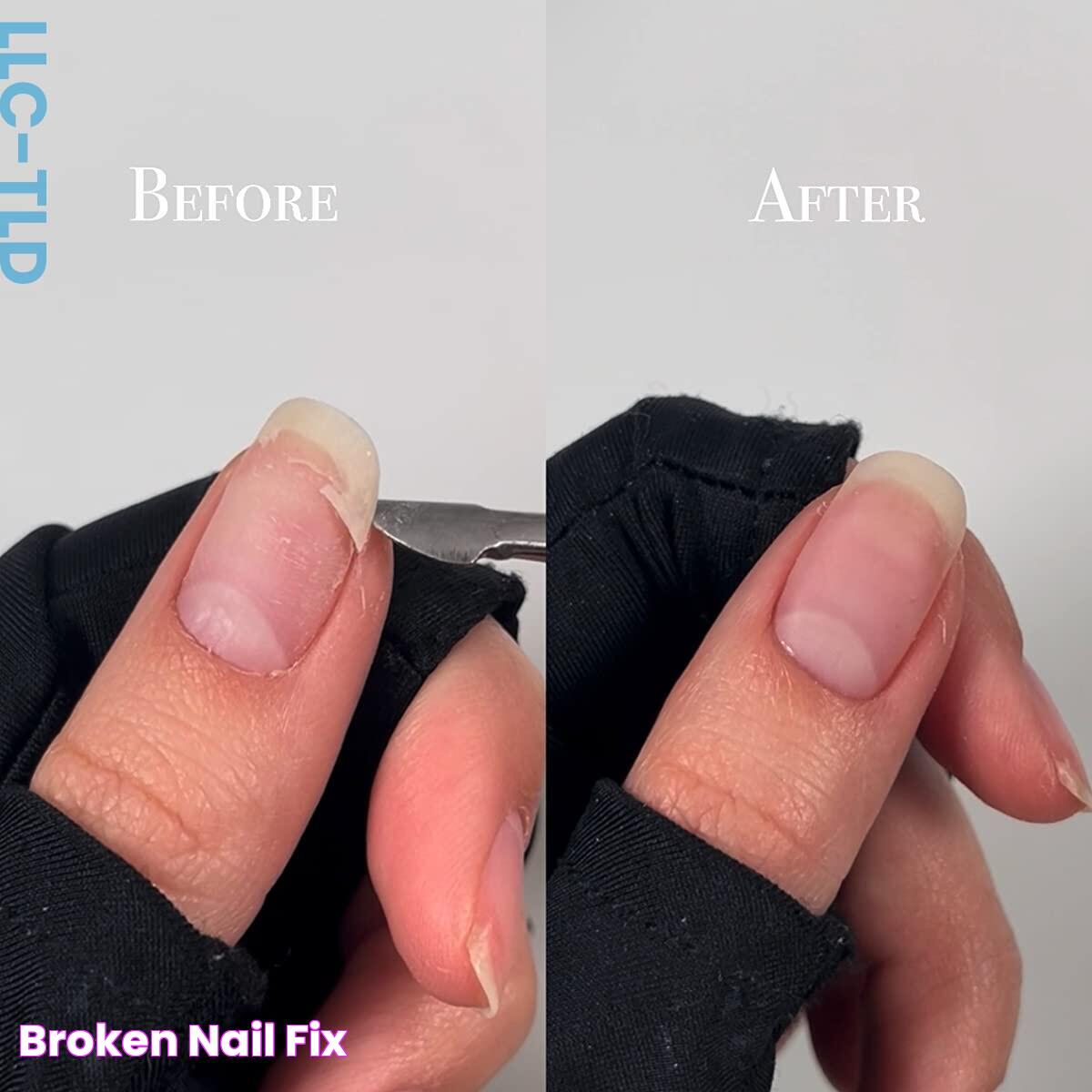 Broken Nail Fix