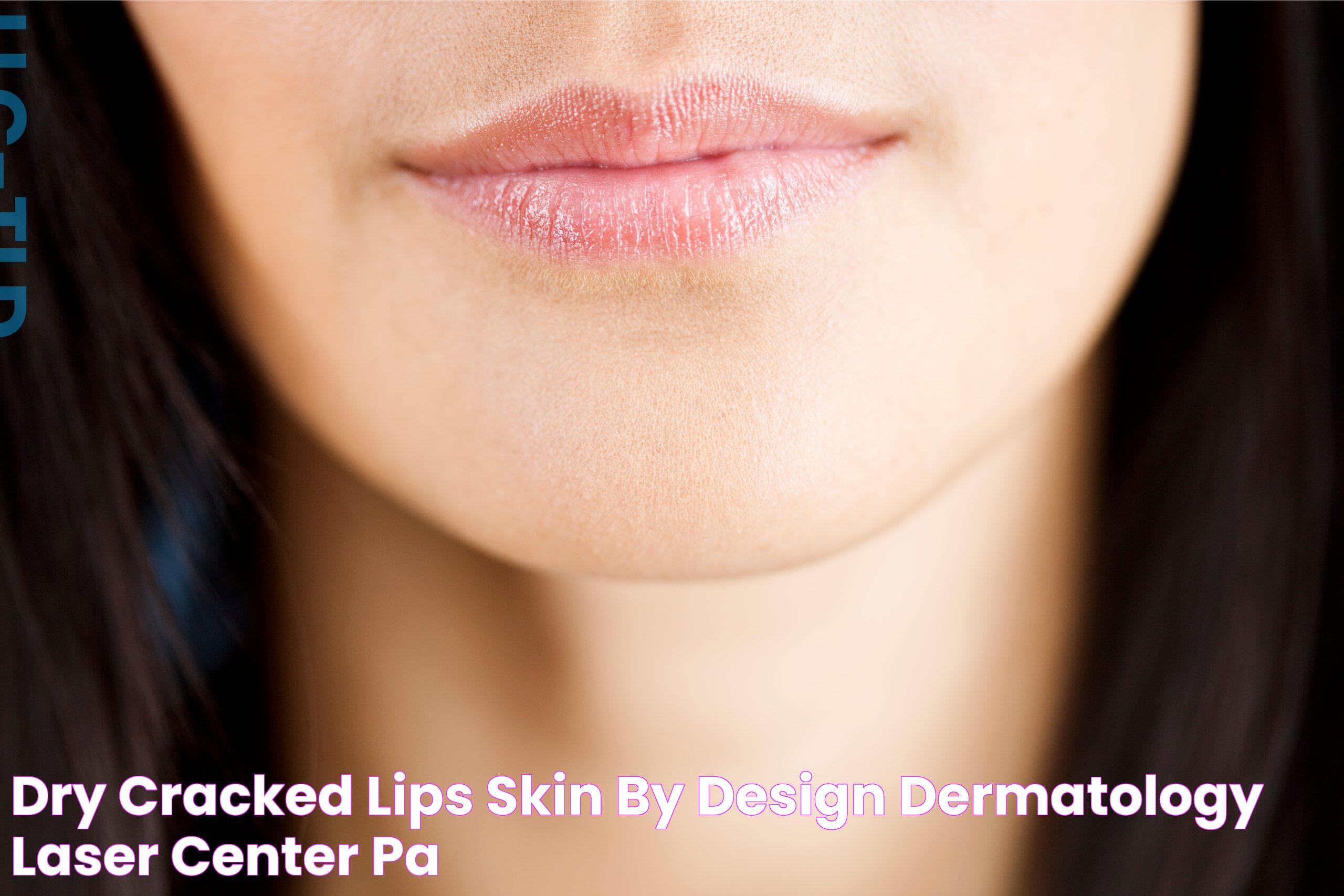 Dry, cracked lips Skin by Design Dermatology & Laser Center, PA