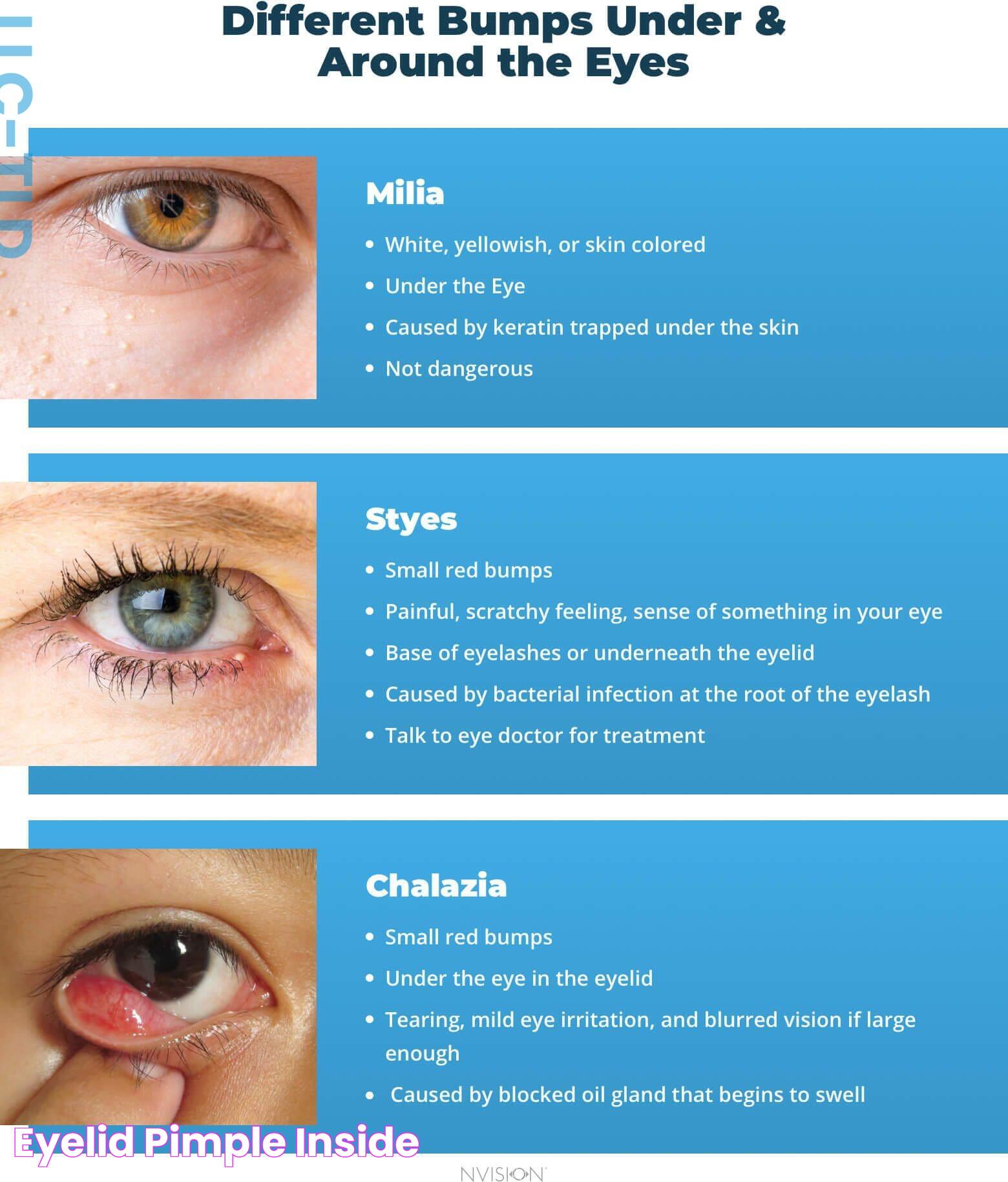 Eyelid Pimple Inside