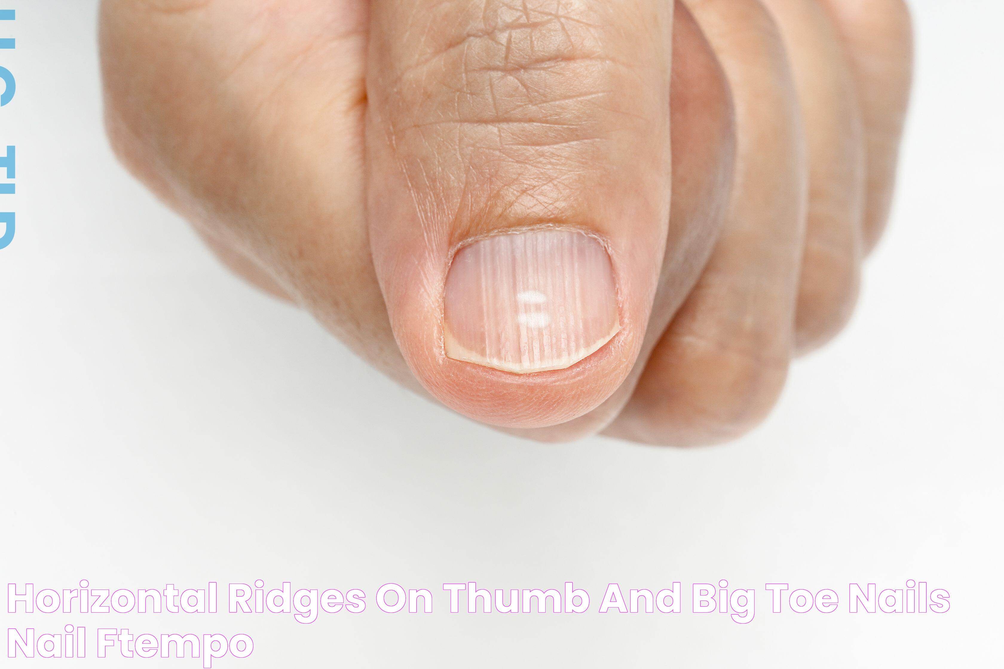 Horizontal Ridges On Thumb And Big Toe Nails Nail Ftempo