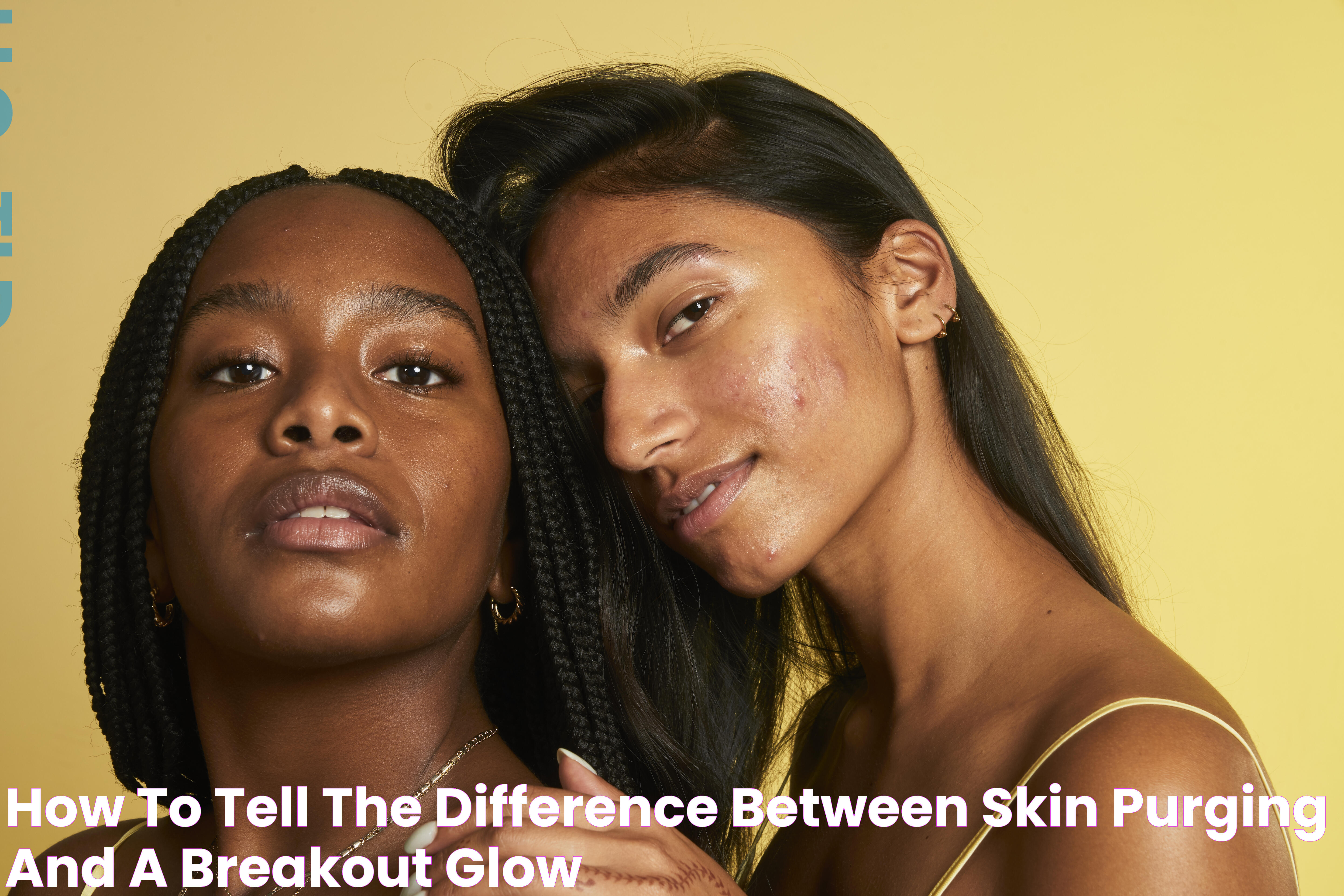 How To Tell The Difference Between Skin Purging and A Breakout Glow