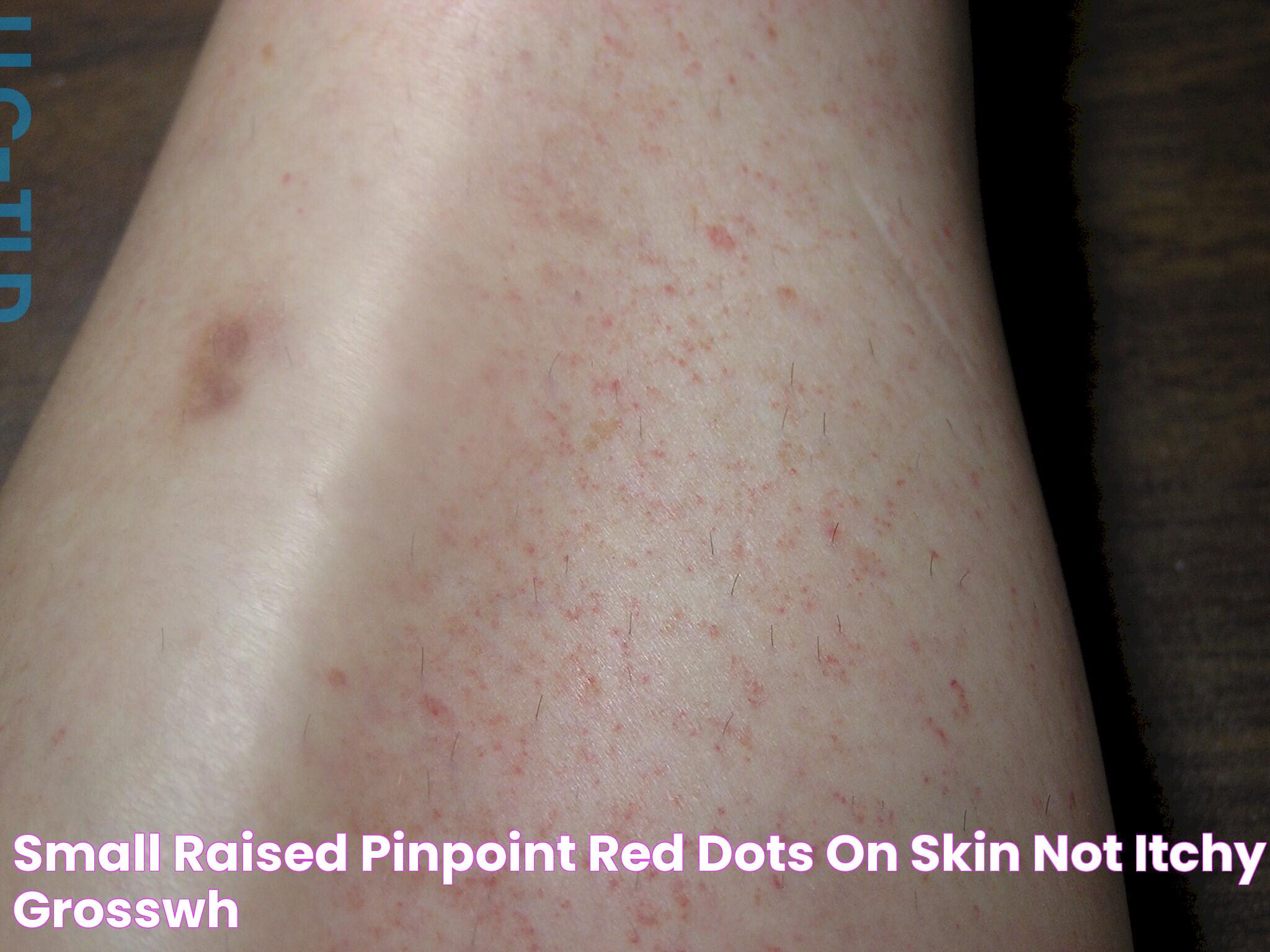 Small raised pinpoint red dots on skin not itchy grosswh