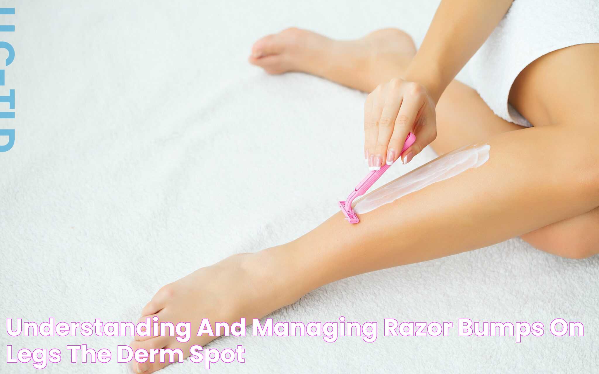 Understanding and Managing Razor Bumps on Legs The Derm Spot